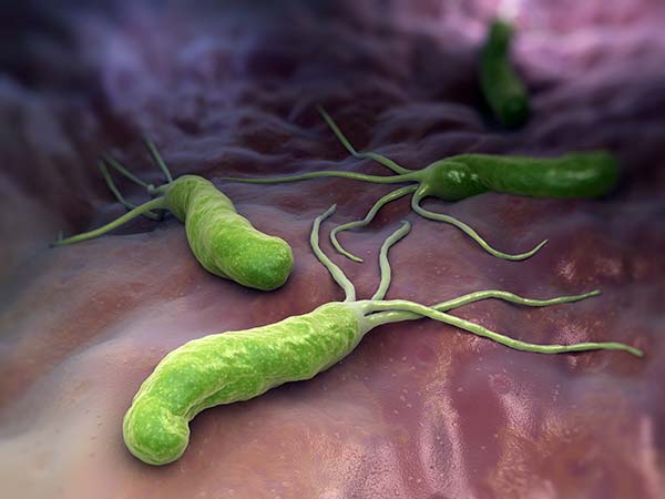 Helicobacter Pylori mit Manuka Honig bekämpfen